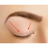 Eyelid Correcting Strips - 6mm