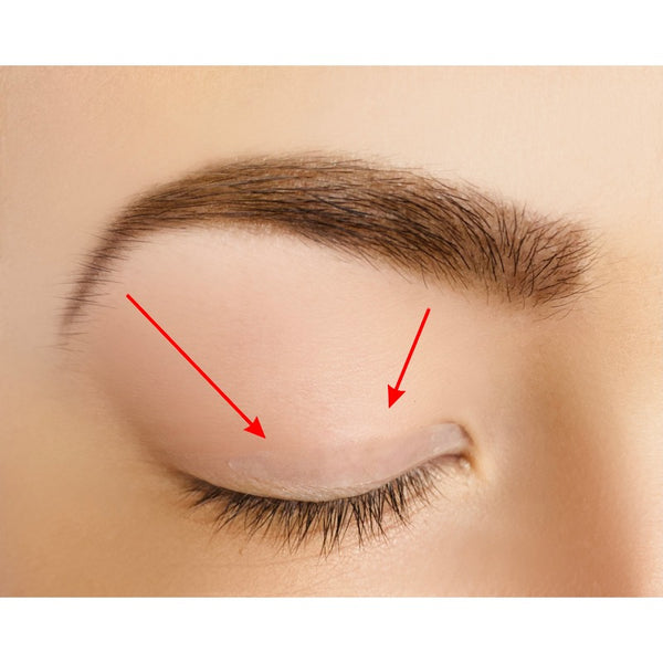 Eyelid Correcting Strips - 6mm