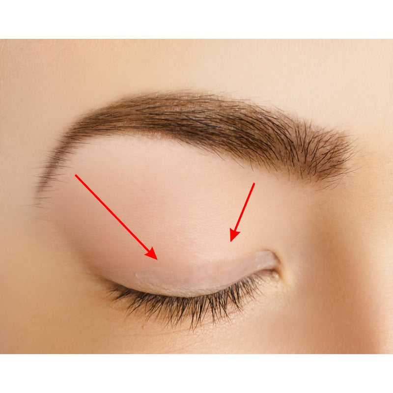 Eyelid Correcting Strips - 4mm